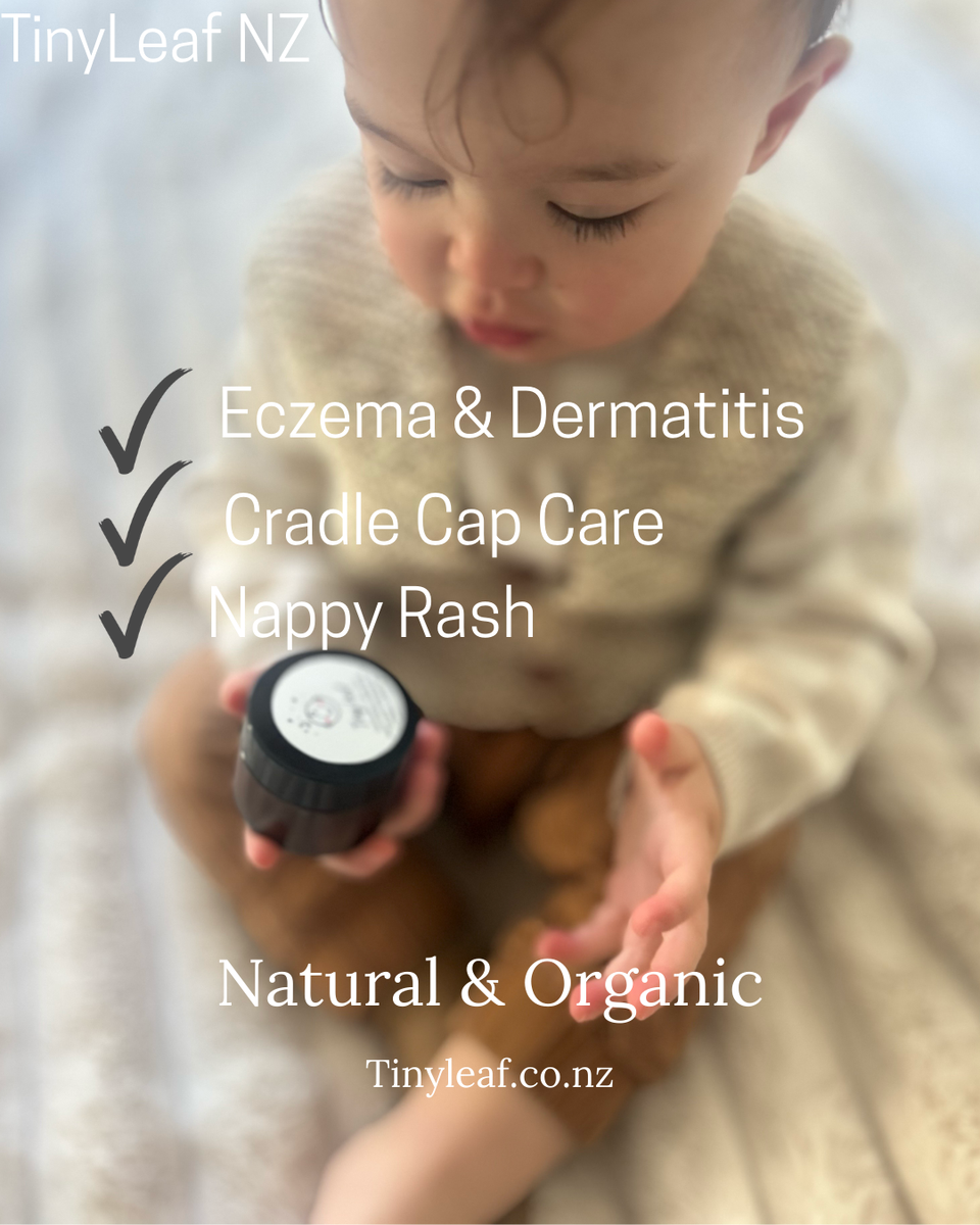 Tiny Leaf Kawakawa Classic Face & Body Balm – Natural Healing for Ecze ...